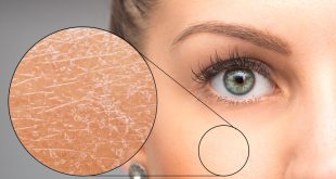 basic skincare untuk memperbaiki skin barrier